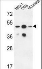 SGMS2 Antibody western blot of MCF-7,CEM,NCI-H460 cell line lysates (35 ug/lane). The SGMS2 antibody detected the SGMS2 protein (arrow).