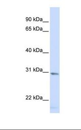 Hela cell lysate. Antibody concentration: 1.0 ug/ml. Gel concentration: 12%.