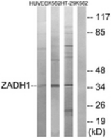 Western blot of extracts from K562/HUVEC/HT-29 cells, using ZADH1 Antibody. The lane on the right is treated with the synthesized peptide.