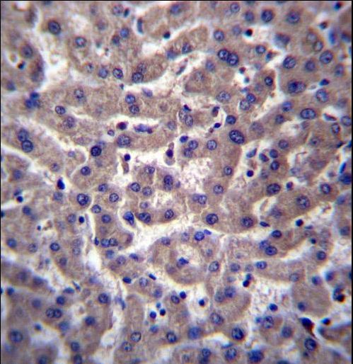 PTGR2 Antibody immunohistochemistry of formalin-fixed and paraffin-embedded human liver tissue followed by peroxidase-conjugated secondary antibody and DAB staining.