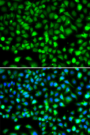 Immunofluorescence blot of MCF7 cell using SMYD1 antibody. Blue: DAPI for nuclear staining.