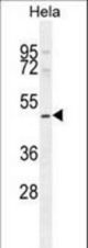 SMYD1 Antibody western blot of HeLa cell line lysates (35 ug/lane). The SMYD1 antibody detected the SMYD1 protein (arrow).