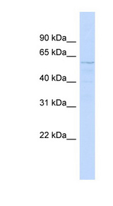 SMYD1 antibody LS-C107797 Western blot of HeLa lysate.