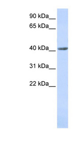 SMYD3 antibody LS-C102367 Western blot of Fetal Stomach lysate.