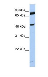 MCF7 cell lysate. Antibody concentration: 1.0 ug/ml. Gel concentration: 12%.