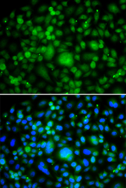 Immunofluorescence blot of MCF7 cell using SMYD3 antibody. Blue: DAPI for nuclear staining.