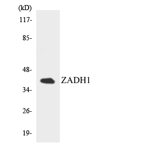 Western blot of the lysates from HepG2 cells using ZADH1 antibody.