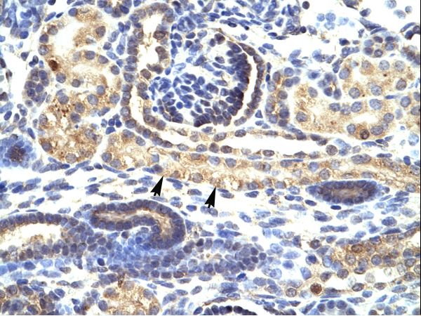 SNAI1 / SNAIL antibody LS-C29804 was used in IHC to stain formalin-fixed, paraffin-embedded human kidney.