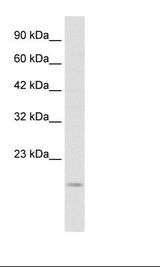 Jurkat Cell Lysate