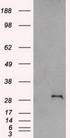 HEK293T cells were transfected with the pCMV6-ENTRY control (Left lane) or pCMV6-ENTRY SNAI1 (Right lane) cDNA for 48 hrs and lysed. Equivalent amounts of cell lysates (5 ug per lane) were separated by SDS-PAGE and immunoblotted with anti-SNAI1.