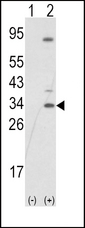 Western blot of SNAIL (arrow) using rabbit polyclonal SNAIL Antibody (N-term R8). 293 cell lysates (2 ug/lane) either nontransfected (Lane 1) or transiently transfected with the SNAIL gene (Lane 2) (Origene Technologies).