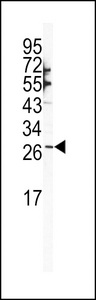 Western blot of SNAIL Antibody (N-term R8) in NCI-H460 cell line lysates (35 ug/lane). SNAIL (arrow) was detected using the purified antibody.