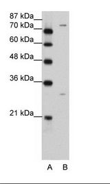 A: Marker, B: Jurkat Cell Lysate