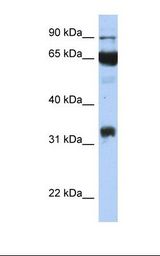 Transfected 293T cell lysate. Antibody concentration: 1.0 ug/ml. Gel concentration: 12%.