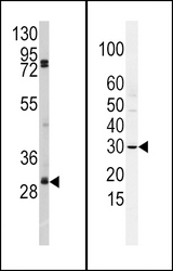(LEFT)Western blot of anti-SLUG Antibody (N-term K9) antibody in A2058 cell line lysates (35 ug/lane). SLUG(arrow) was detected using the purified antibody.(RIGHT)Western blot of SLUG Antibody (N-term K9) in HCSMC cell line lysates (35 ug/lane). SLUG (arrow) was detected using the purified antibody.