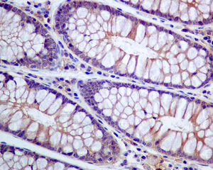 IHC of paraffin-embedded human colon tissue using anti-SNAP23 antibody.
