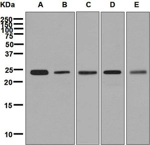 Western blot analysis on (A) HeLa, (B) human placenta, (C) BxPC-3, (D) HepG2, and (E) JAR cell lysates using anti-SNAP23 antibody.