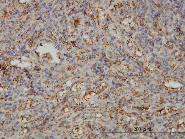 Immunoperoxidase of monoclonal antibody to SNAP23 on formalin-fixed paraffin-embedded human spleen. [antibody concentration 3 ug/ml].