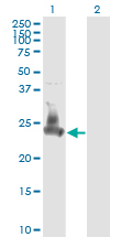 Western blot of SNAP23 expression in transfected 293T cell line by SNAP23 monoclonal antibody (M01), clone 2F5-3D4.