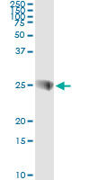 Immunoprecipitation of SNAP23 transfected lysate using anti-SNAP23 monoclonal antibody and Protein A Magnetic Bead.