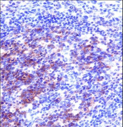 SNAP23 Antibody immunohistochemistry of formalin-fixed and paraffin-embedded human tonsil tissue followed by peroxidase-conjugated secondary antibody and DAB staining.