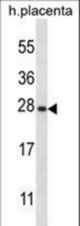 SNAP23 Antibody western blot of human placenta tissue lysates (35 ug/lane). The SNAP23 antibody detected the SNAP23 protein (arrow).