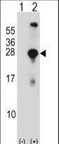 Western blot of SNAP23 (arrow) using rabbit polyclonal SNAP23 Antibody. 293 cell lysates (2 ug/lane) either nontransfected (Lane 1) or transiently transfected (Lane 2) with the SNAP23 gene.