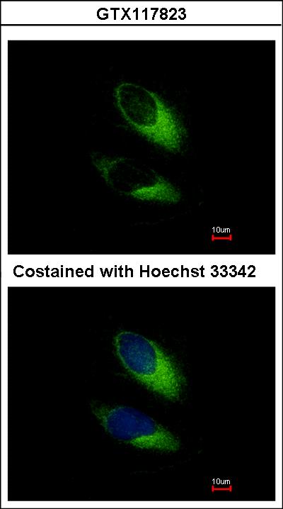 Immunofluorescence of methanol-fixed HeLa, using SNAP23 antibody at 1:500 dilution.