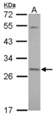 Sample (30 ug of whole cell lysate) A: A431 12% SDS PAGE SNAP23 antibody diluted at 1:500