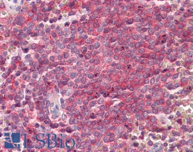 Anti-SNAP23 antibody IHC of human spleen. Immunohistochemistry of formalin-fixed, paraffin-embedded tissue after heat-induced antigen retrieval. Antibody LS-B8340 dilution 3.75 ug/ml.