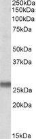 SNAP23 antibody (0.1 ug/ml) staining of Human Placenta lysate (35 ug protein/ml in RIPA buffer). Primary incubation was 1 hour. Detected by chemiluminescence.