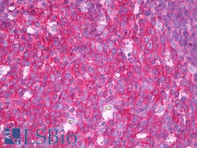 Anti-SNAP23 antibody IHC of human tonsil, germinal center. Immunohistochemistry of formalin-fixed, paraffin-embedded tissue after heat-induced antigen retrieval. Antibody LS-B7523 concentration 10 ug/ml.