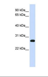 Jurkat cell lysate. Antibody concentration: 1.0 ug/ml. Gel concentration: 12%.
