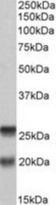 SNAP23 antibody (0.2 ug/ml) staining of PBMC lysate (35 ug protein/ml in RIPA buffer). Primary incubation was 1 hour. Detected by chemiluminescence.