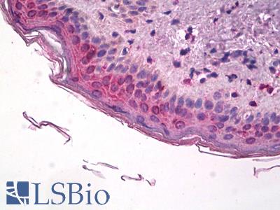 Anti-PTGS1 / COX-1 antibody IHC of human skin. Immunohistochemistry of formalin-fixed, paraffin-embedded tissue after heat-induced antigen retrieval. Antibody LS-B3229 concentration 3.75 ug/ml.
