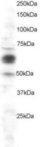 Staining (1 ug/ml) of HeLa lysate (RIPA buffer, 30 ug total protein per lane). Primary incubated for 1 hour. Detected using chemiluminescence.