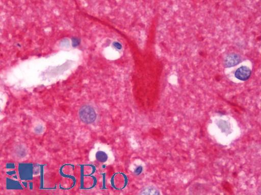 Anti-SNAP25 antibody IHC staining of human brain, cortex. Immunohistochemistry of formalin-fixed, paraffin-embedded tissue after heat-induced antigen retrieval. Antibody LS-B10970 dilution 1:100.