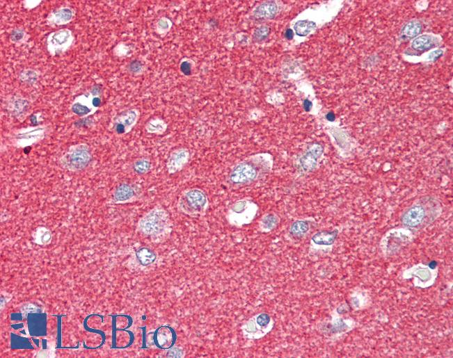 Anti-SNAP25 antibody IHC of human brain, cortex. Immunohistochemistry of formalin-fixed, paraffin-embedded tissue after heat-induced antigen retrieval. Antibody LS-B2392 concentration 5 ug/ml.