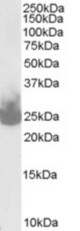 (0.03 ug/ml) staining of Mouse Brain lysate (35 ug protein in RIPA buffer). Primary incubation was 1 hour. Detected by chemiluminescence.