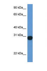 SNAP29 antibody LS-C145252 Western blot of Rat Lung lysate. Antibody concentration 1 ug/ml.