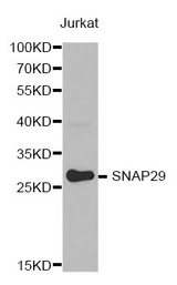 Western blot analysis of extracts of Jurkat cell line, using SNAP29 antibody.