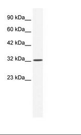 Jurkat Cell Lysate