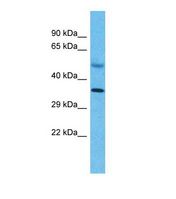 Western blot of Human Liver Tumor. SNAPC2 antibody dilution 1.0 ug/ml.