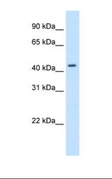 Transfected 293T cell lysate. Antibody concentration: 1.25 ug/ml. Gel concentration: 12%.