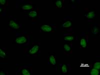 Immunostaining analysis in HeLa cells. HeLa cells were fixed with 4% paraformaldehyde and permeabilized with 0.1% Triton X-100 in PBS. The cells were immunostained with anti-SNAPC1 mAb.