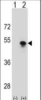 Western blot of SNAPC1 (arrow) using rabbit polyclonal SNAPC1 Antibody. 293 cell lysates (2 ug/lane) either nontransfected (Lane 1) or transiently transfected (Lane 2) with the SNAPC1 gene.
