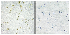 IHC of paraffin-embedded human brain tissue, using SNAPC5 Antibody. The sample on the right was incubated with synthetic peptide.