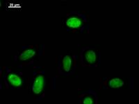 Immunostaining analysis in HeLa cells. HeLa cells were fixed with 4% paraformaldehyde and permeabilized with 0.1% Triton X-100 in PBS. The cells were immunostained with anti-SNAPC5 mAb.
