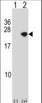 Western blot of Park4 (arrow) using rabbit polyclonal Park4 Antibody. 293 cell lysates (2 ug/lane) either nontransfected (Lane 1) or transiently transfected (Lane 2) with the Park4 gene.