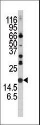 Western blot of anti-Alpha-synuclein antibody in mouse brain tissue lysate. Alpha-synuclein (arrow) was detected using the purified antibody.